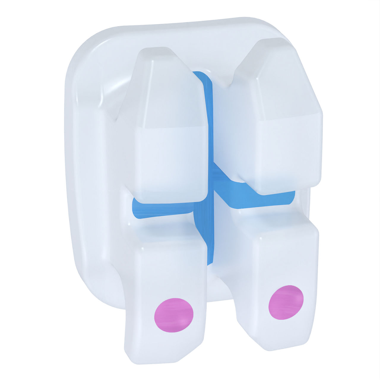 3M™ Clarity™ Advanced Ceramic Brackets, 4006-250, APC™ Flash-Free, .018, L1-2, -6T/0A, 5/Pk