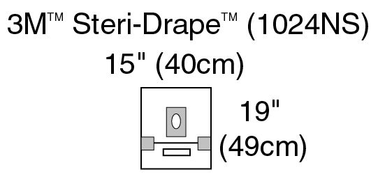 3M™ Steri-Drape™ Small Drape with Adhesive Aperture and Pouch 1024NS,200/CS