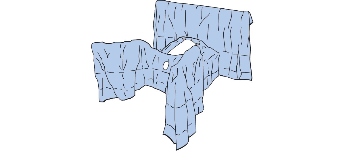 Steri-Drape Laparotomy/Laparoscopy Drape