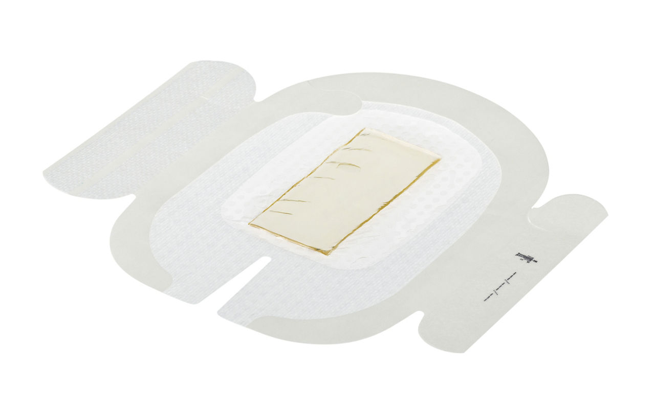 3M™ Tegaderm™ CHG Chlorhexidine Gluconate I.V. Securement Dressing, 1659NS, 4 in x 6 1/8 in, Bulk, 500/CS