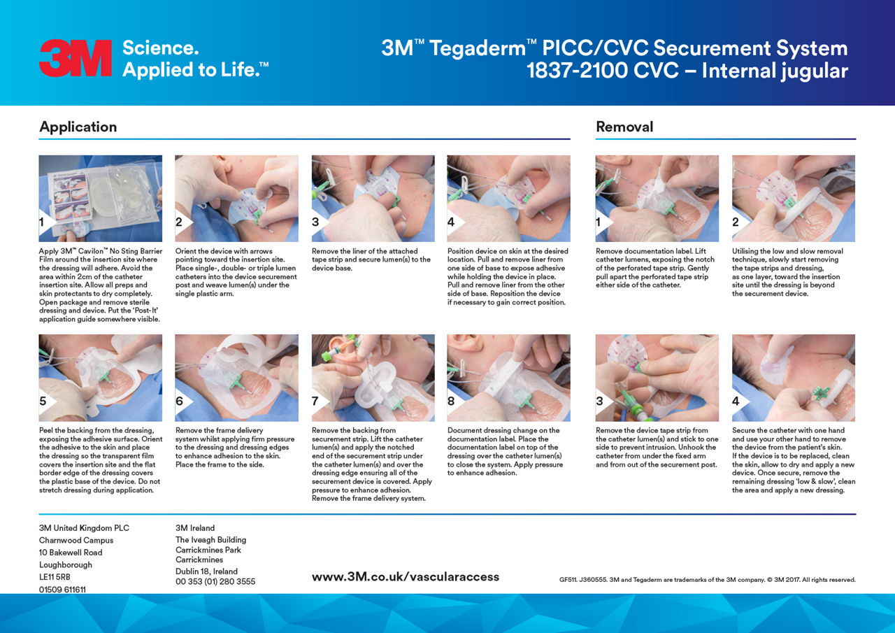 1837-2100 CVC Jugular Application guide