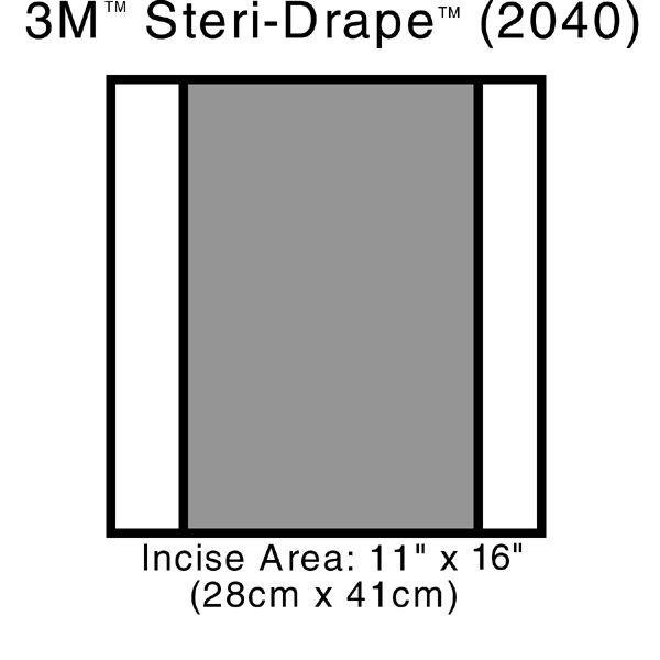 3M™ Steri-Drape™ 2 İnsizyon Örtüsü, 2000 Serisi