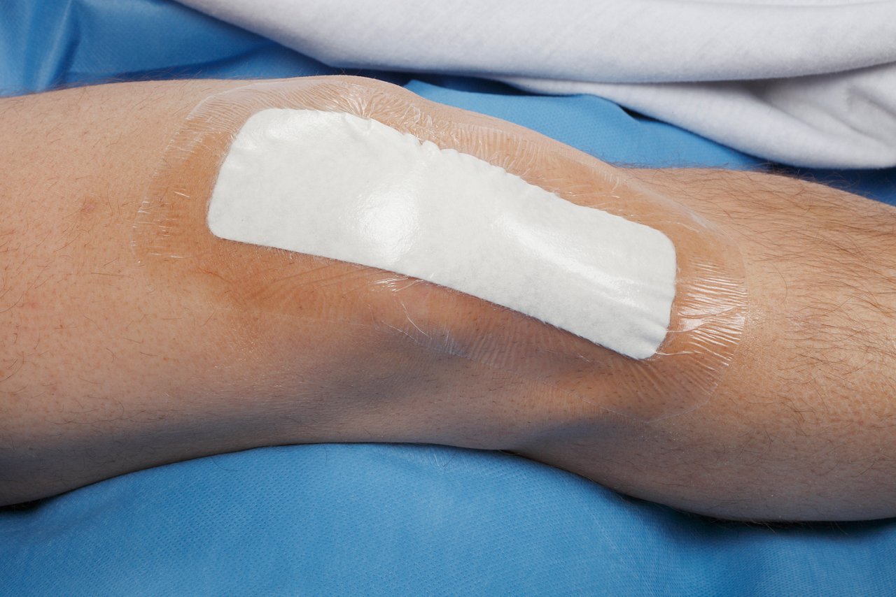 Tegaderm +Pad Filmverband op knie, 3590