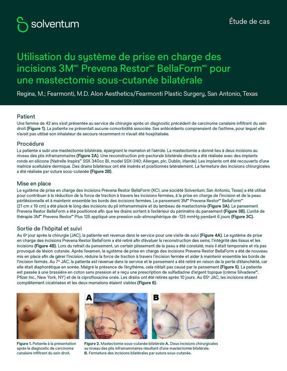 Prévisualisation de la couverture de l'étude de cas sur le système de gestion des incisions Prevena Restor BellaForm pour mastectomie