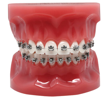 3M™ Victory Series™ Active Self-Ligating Brackets Typodont, 600-241,1/Ea