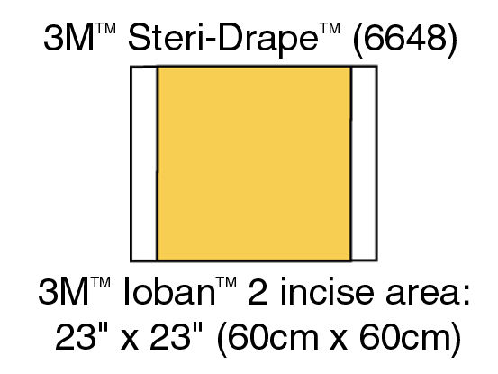 3M™ Ioban™ 2 6648 Campo de Incisión Antimicrobiano 56cm x 60cm, 10UN/CJA 4CJA/EBJE