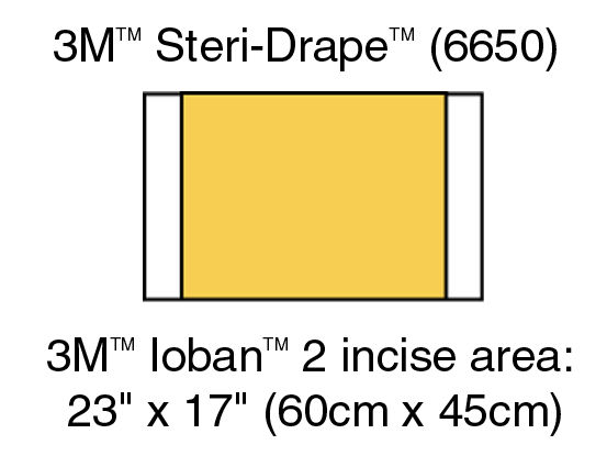 3M™ Ioban™ 2 Anti-microbiële Incisiefolie, 6650, 56 cm x 45 cm, 10 stuks/doos