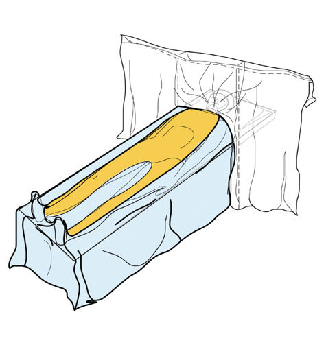 Steri-Drape™ Cardiovascular Sheet with Ioban™ 2 Incise Film