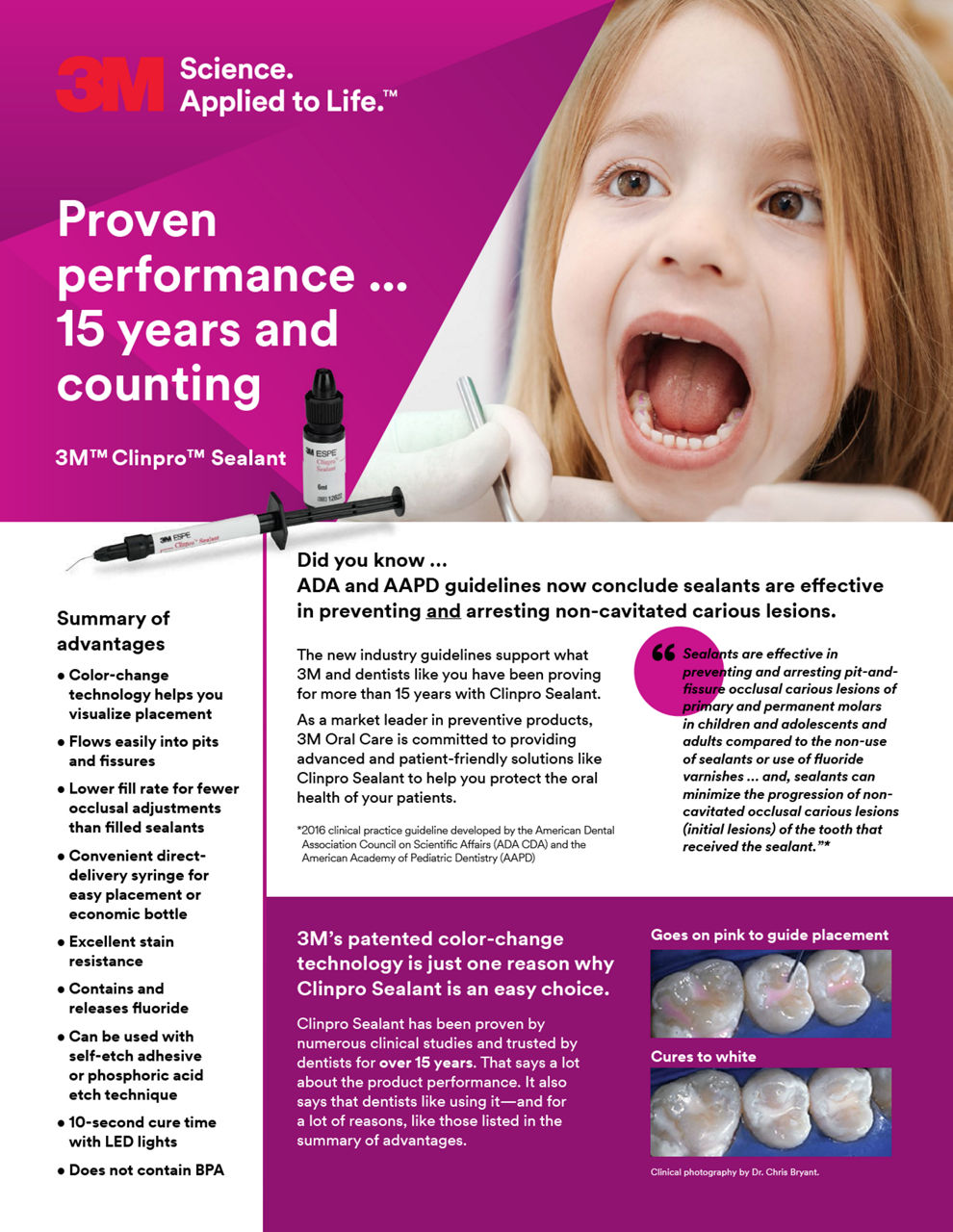 Clinpro™ Sealant Proven Performance