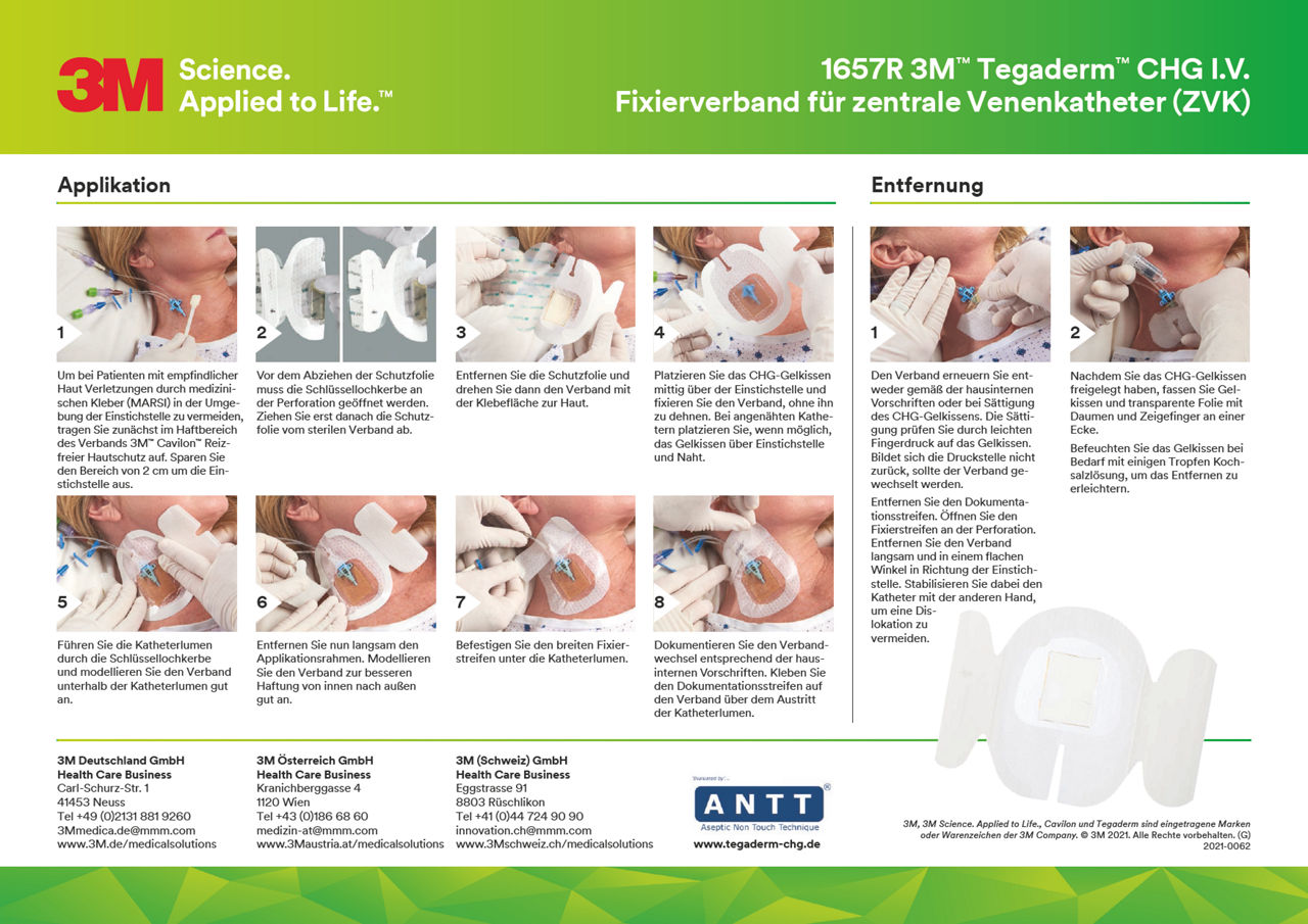 3M™ Tegaderm™ CHG 1657R Applikationsanleitung DACH-de