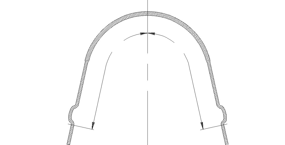3M Unitek Series 5 Facebows, Adjustable Loop