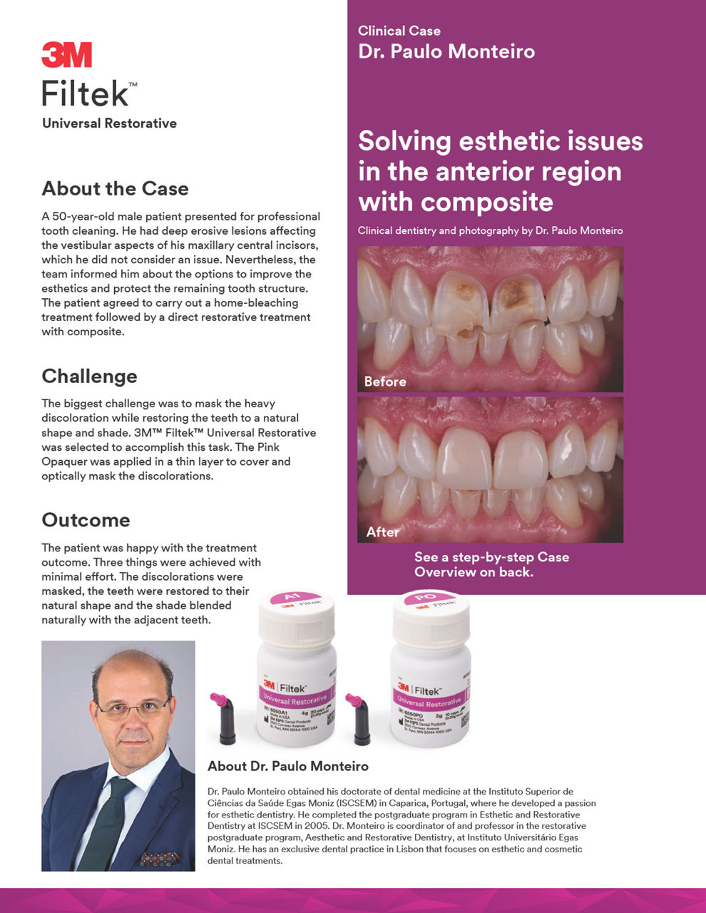 Filtek™ Universal Restorative Central Incisor Clinical Case