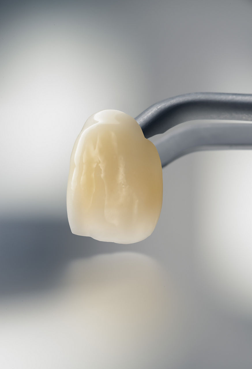 3M™ Lava™ Esthetic Zirconia A2 anterior crown