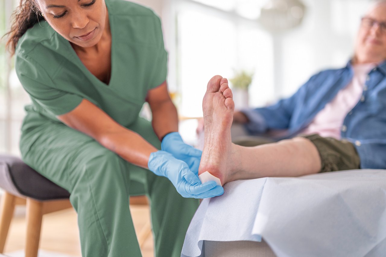 Clinician applying 3M™ Promogran Prisma™ Matrix to patient's heel, TIF File.