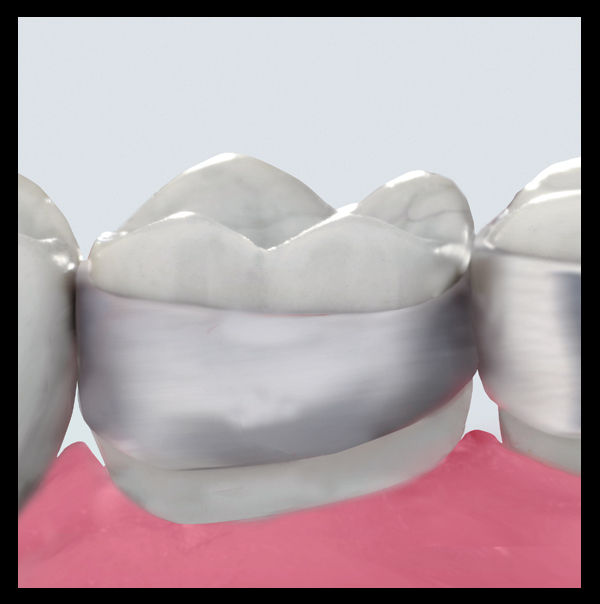 3M™ Victory Series™ First Molar Bands, 902-266, Upper, Right, Size 33,Narrow, Contoured, Regular, Ea