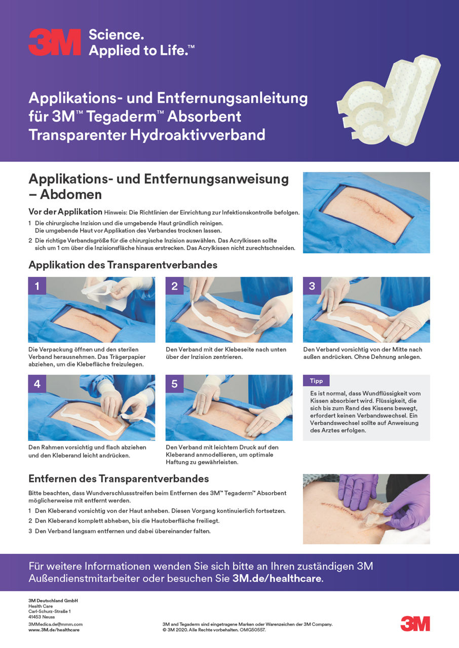 3M™ Tegaderm™ Absorbent Applikationsanleitung Abdomen DE-de