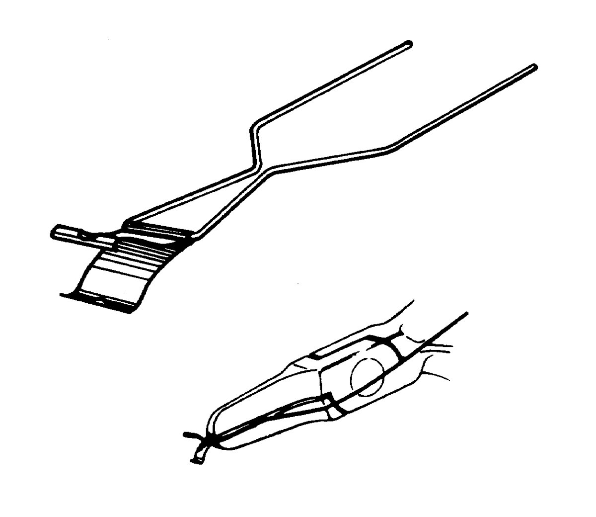 3M Unitek Steiner Rotating Spring Wedge