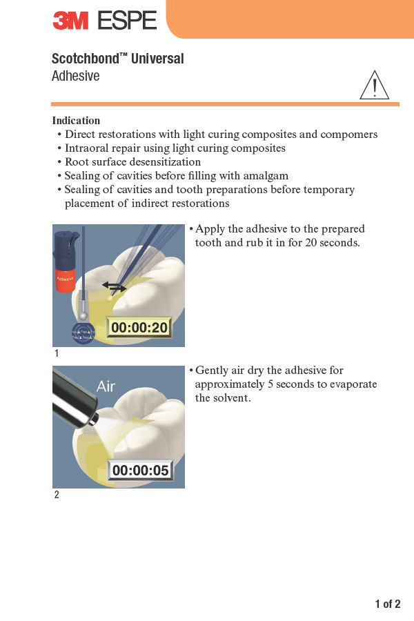 Scotchbond Universal Direct Restorations Procedure Guide