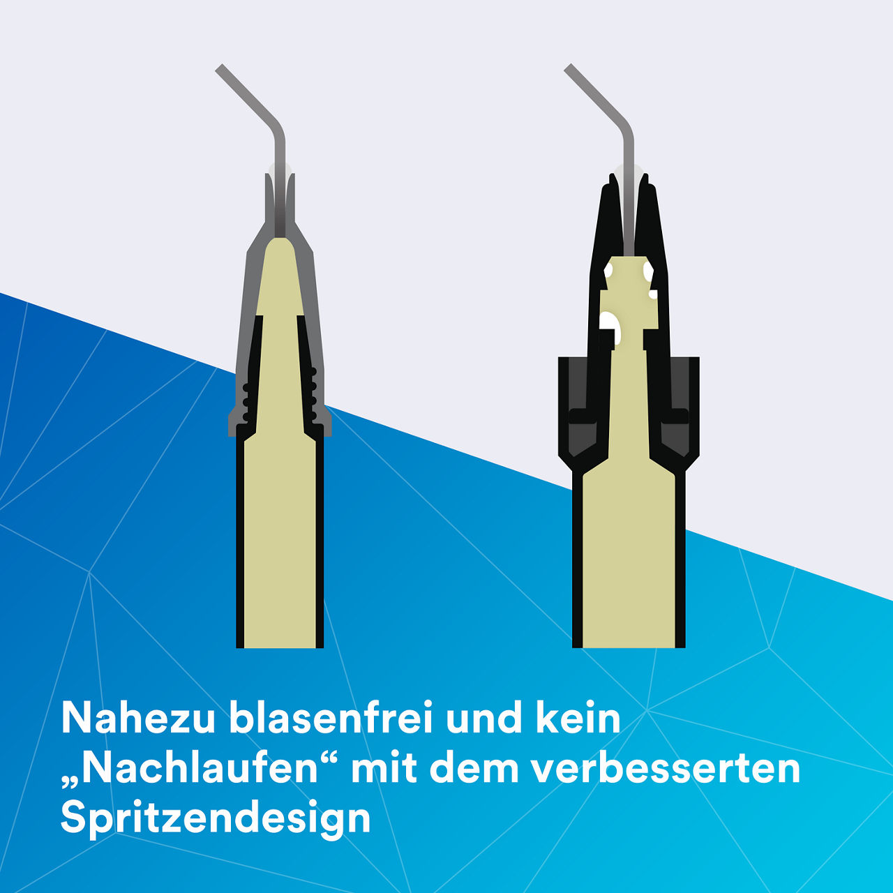 ZZ-Archive 2- Filtek Supreme Flowable Syringe: Nahezu blasenfrei und kein „Nachlaufen“
