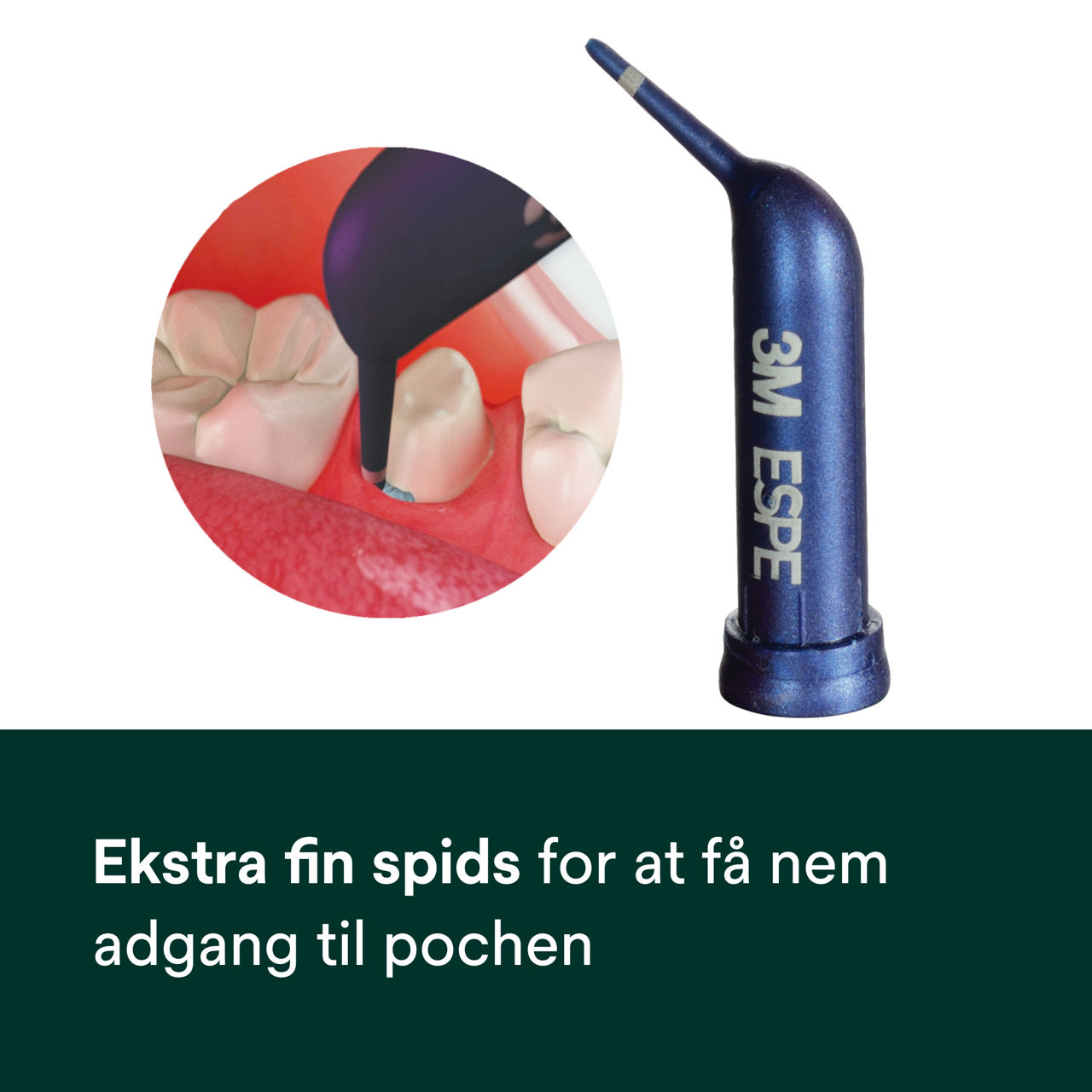 (2) Astringent Retraction Paste: Ekstra fin spids