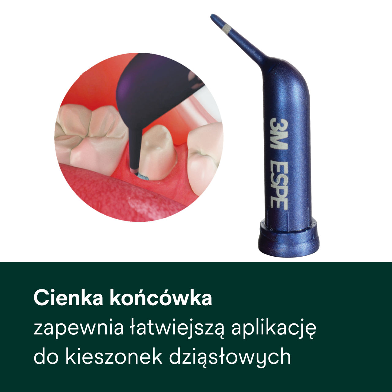 (2) Astringent - Pasta retrakcyjna: Cienka końcówka