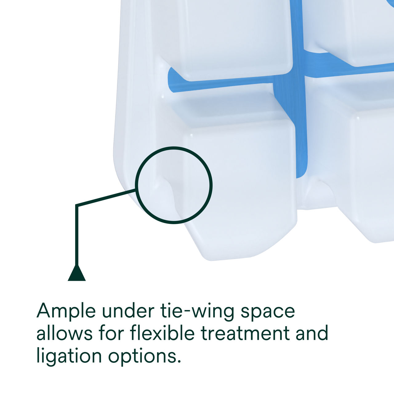 (2) Clarity Advanced Ceramic Brackets: Ample under tie-wing space