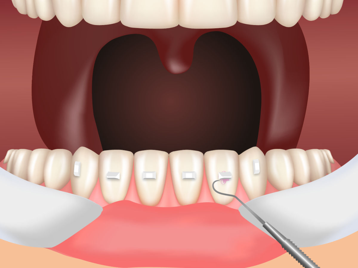 Verificar