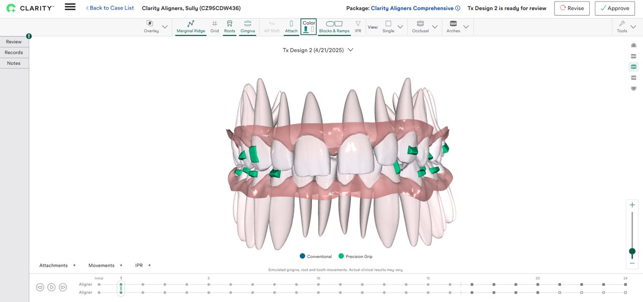 Kuva Tx Designer -sivusta, jossa on yksittäiset juuret ja tarkka ote.