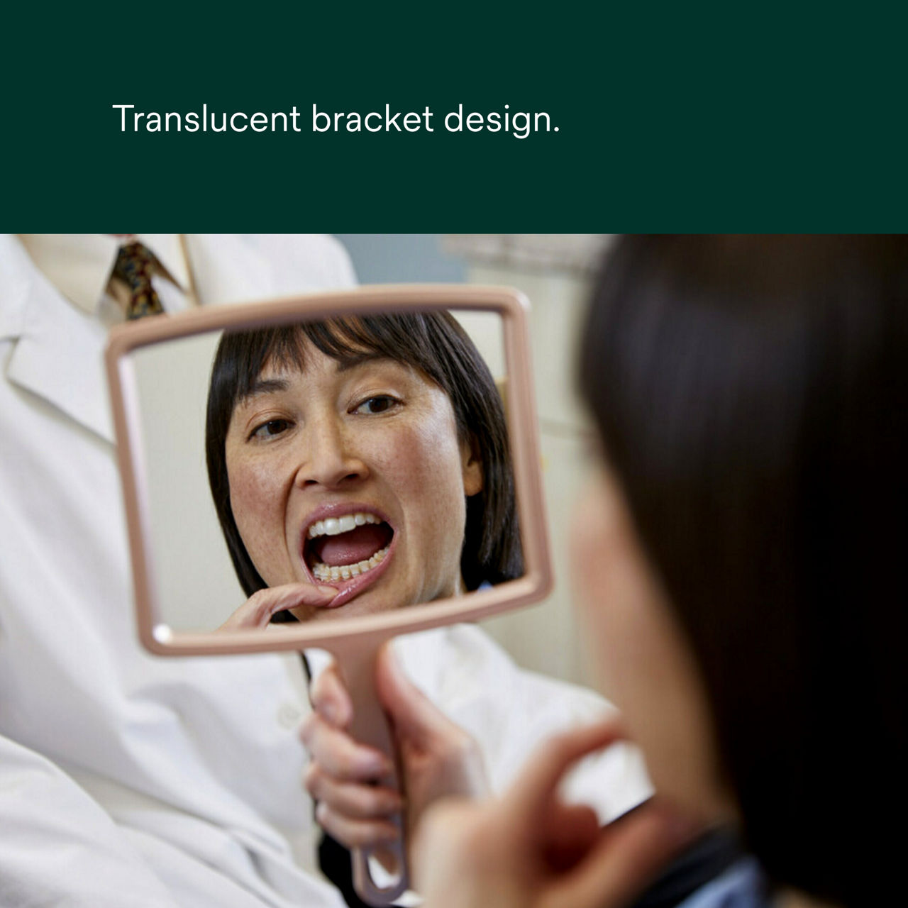 (1) Clarity Ultra Self-Ligating Ceramic Brackets: Translucent bracket design