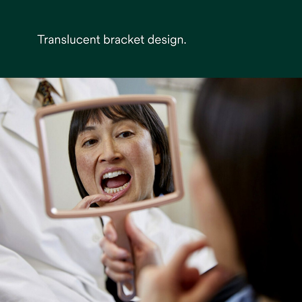 Clarity Ultra Self-Ligating Ceramic Brackets