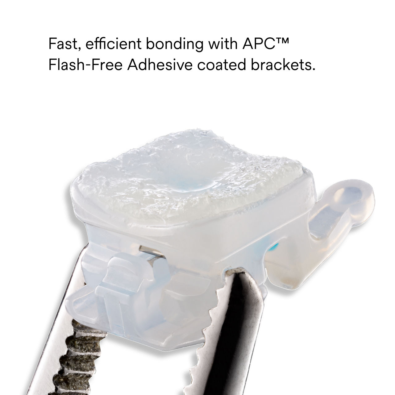 (5) Clarity Ultra Self-Ligating Ceramic Brackets: Fast,efficient bonding