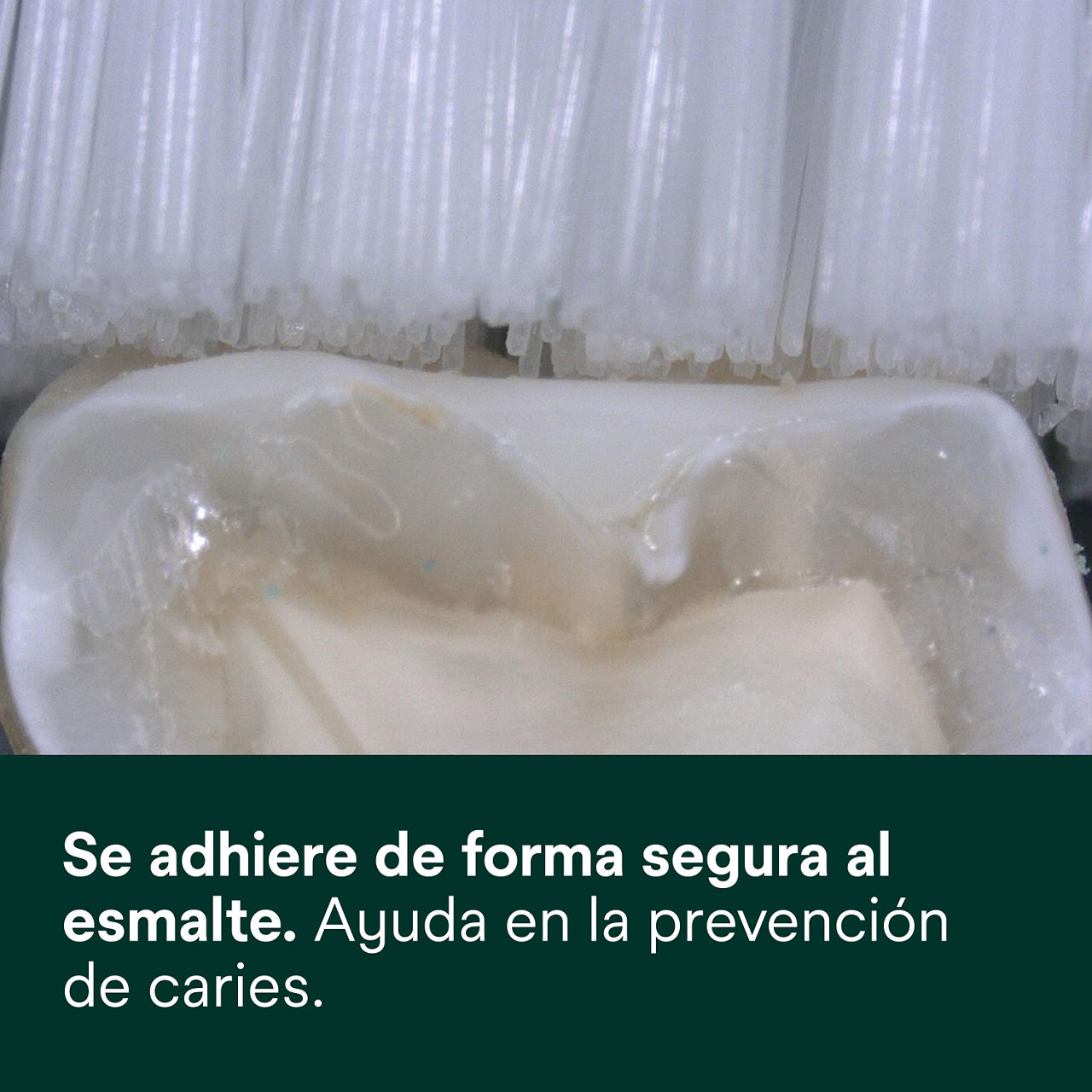 (3) Clinpro Sellante: Se adhiere firmemente al esmalte, ayuda a prevenir caries.