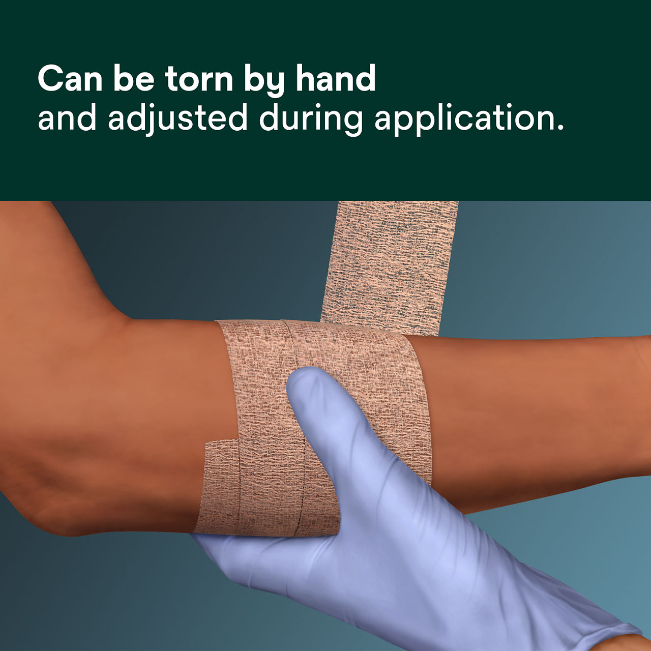 (2) Coban NL: Can be torn by hand and adjusted during application