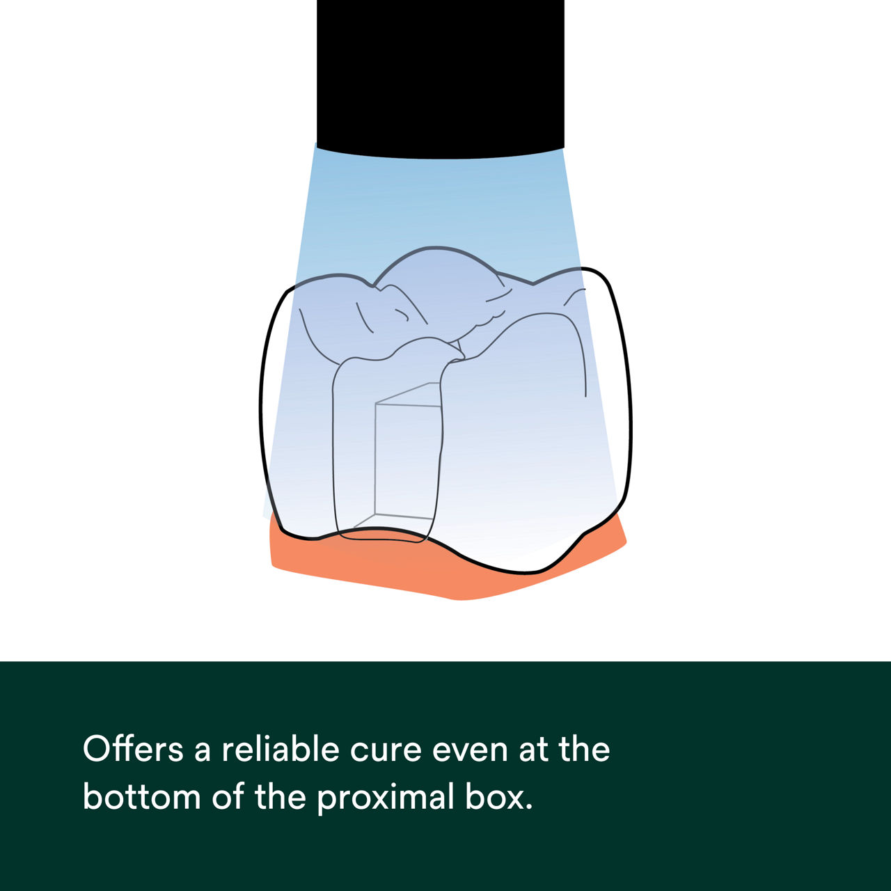 Elipar Deepcure S LED Curing Light PDP Secondary Image 4