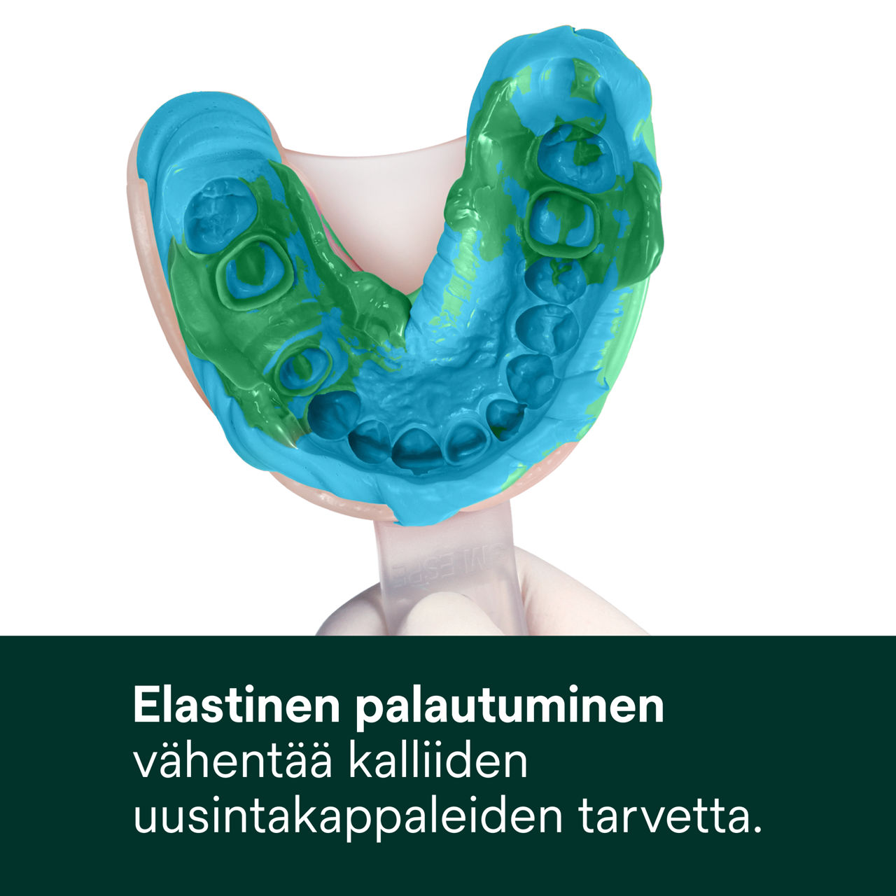 (3) Express™ 2 - Quick Set - Elastinen palautuminen