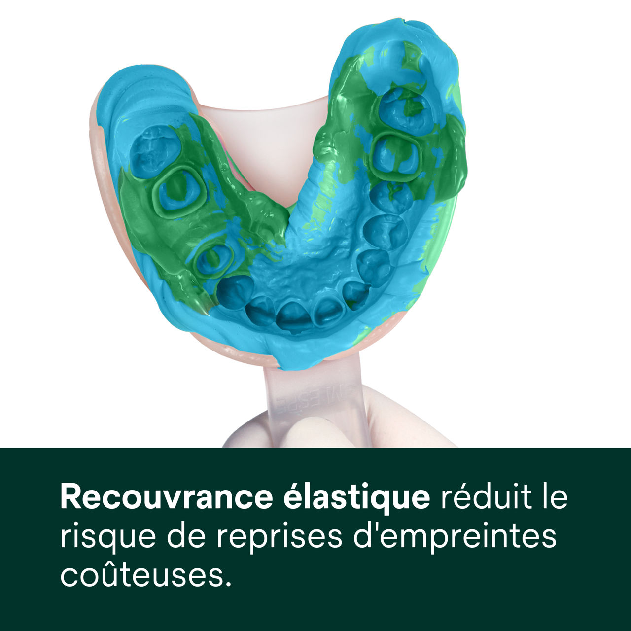 (3) Express™ 2 - Quick Set - Recouvrance élastique