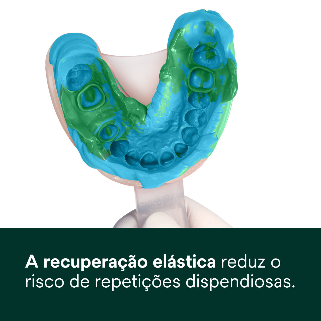 (3) Express™ 2 - Quick Set - Recuperação elástica
