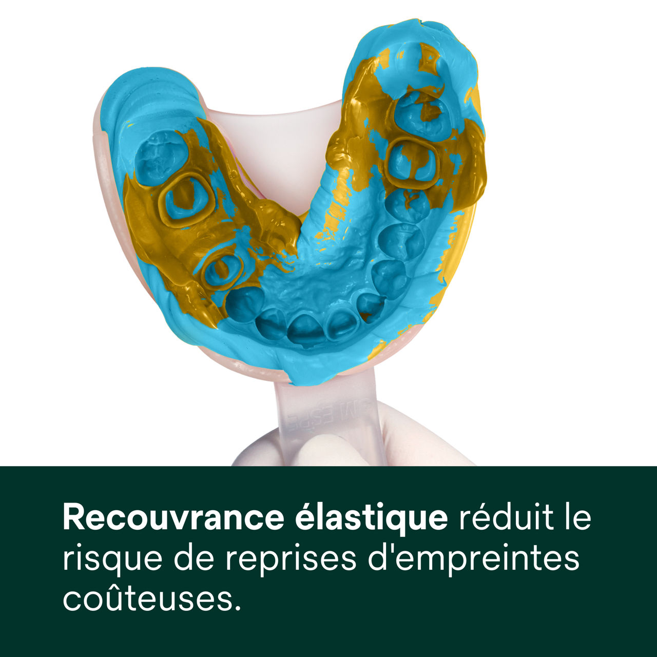 (3) Express™ 2 - Regular Set - Recouvrance élastique