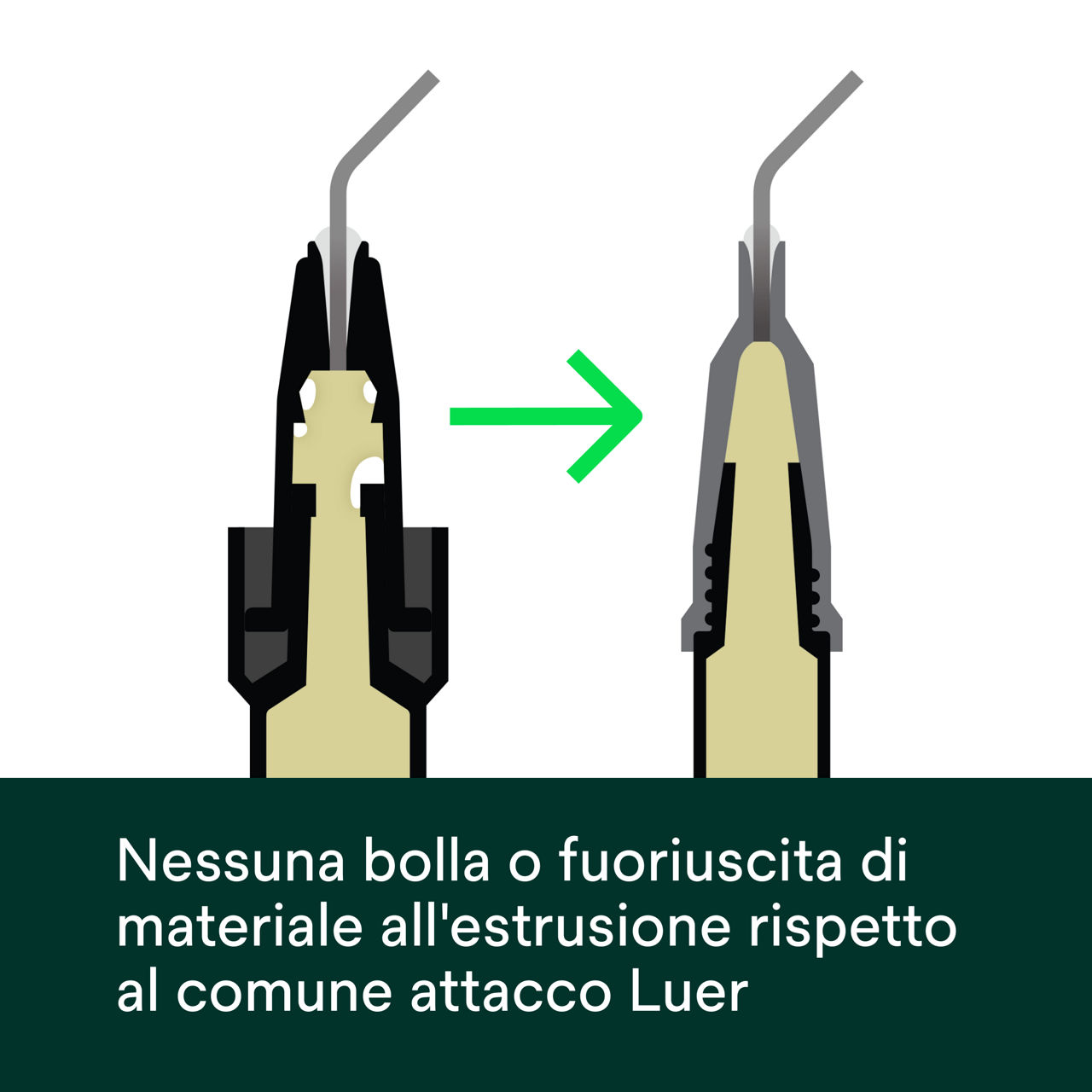 (3b) Filtek™ Easy Match Flowable - Nessuna bolla o fuoriuscita