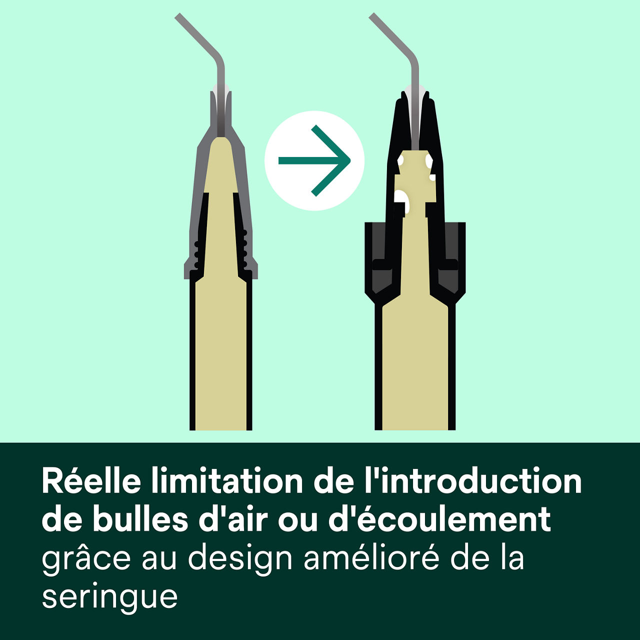 2- Filtek™ Bulk Fill Flowable Syringe: Réelle limitation de l'introduction de bulles d'air