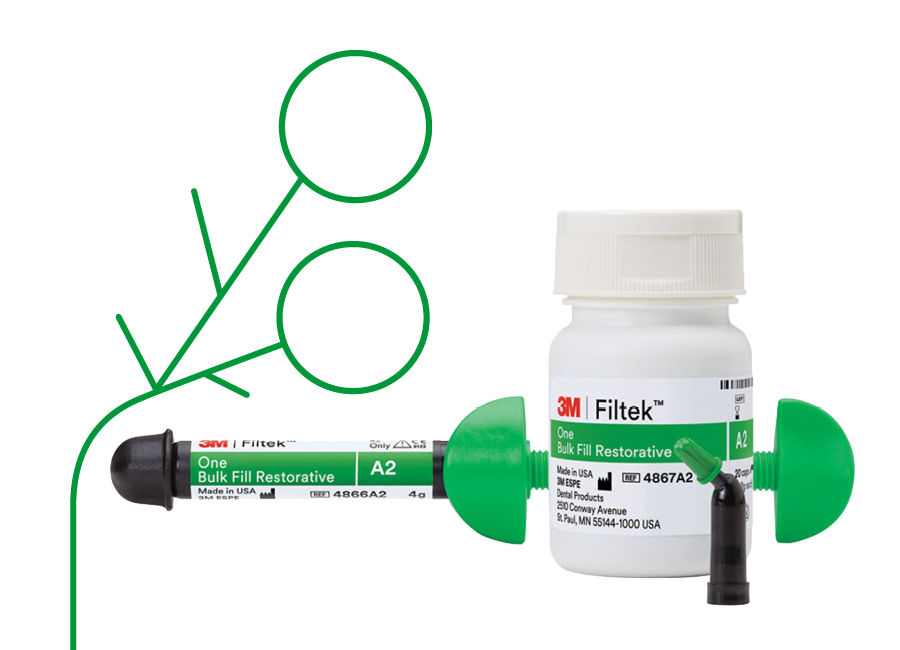 Solventum restorative technique