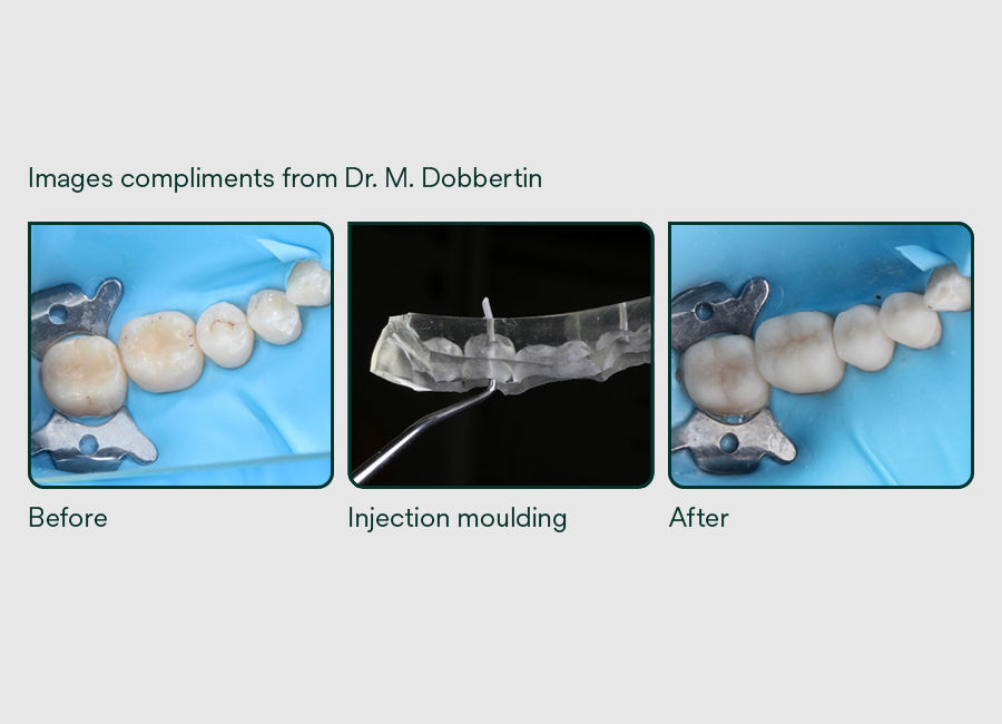 Dental professional consulting with a patient during restorative treatment