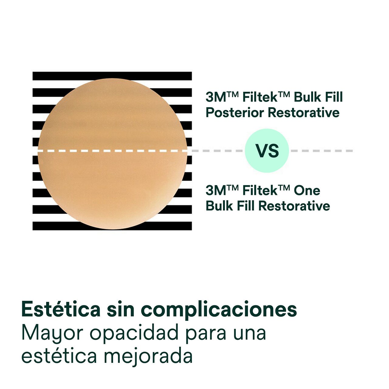3- Filtek One Bulk Fill: Estética sin complicaciones