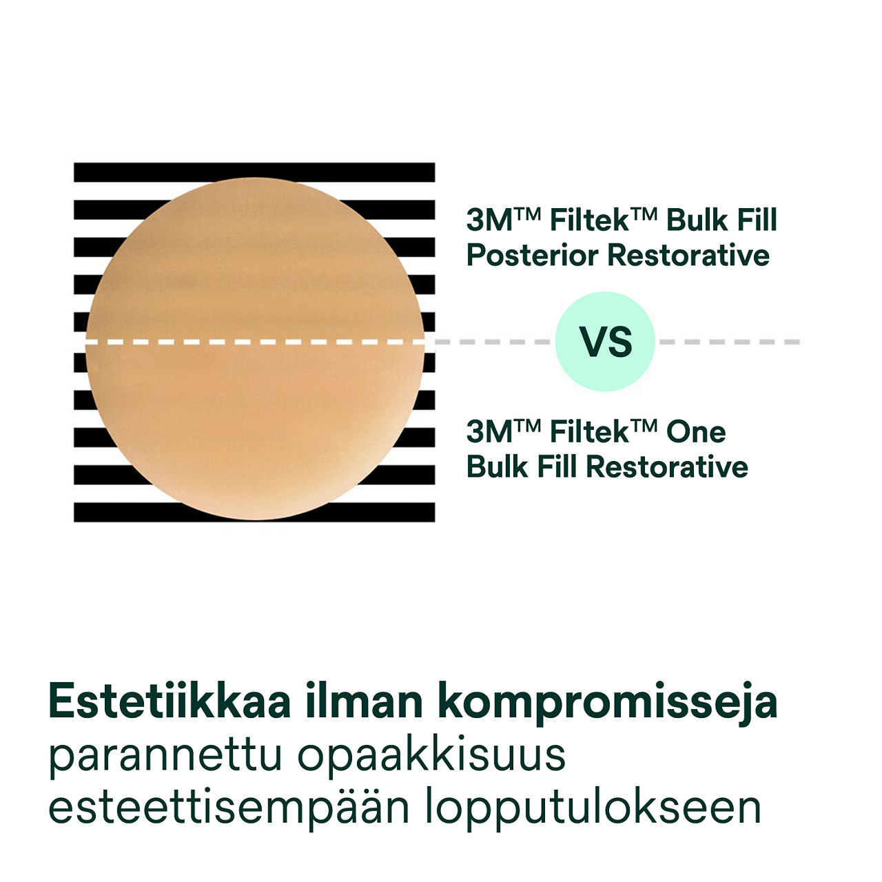 3- Filtek One Bulk Fill: Estetiikkaa ilman kompromisseja