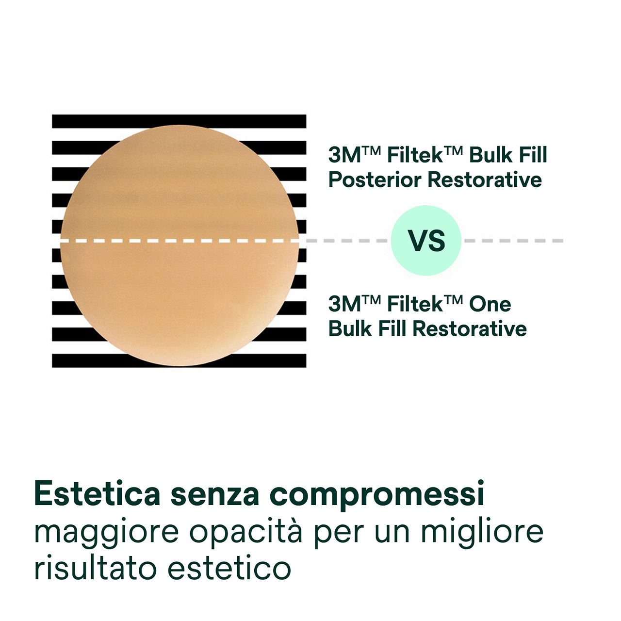 3- Filtek One Bulk Fill: Estetica senza compromessi: