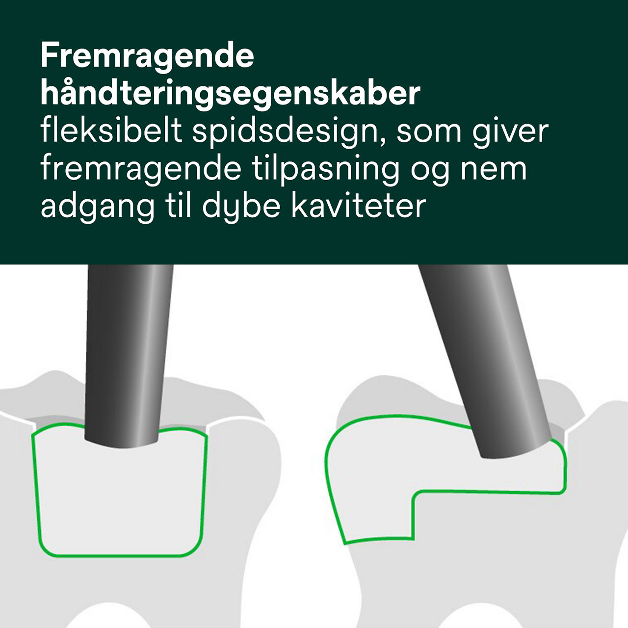 4- Filtek One Bulk Fill: Fremragende håndteringsegenskaber –
