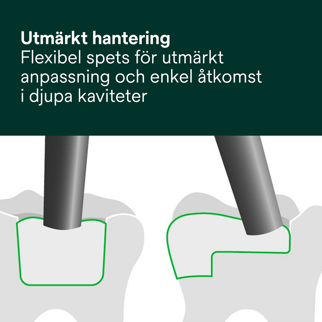 4- Filtek™ One Bulk Fill: Utmärkt hantering