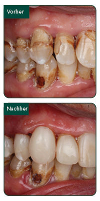 Clinical before and after image