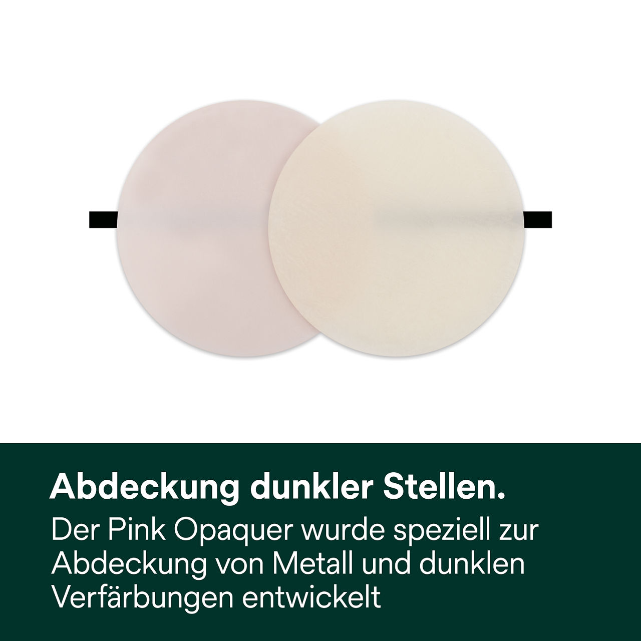 3- Filtek Universal: Abdeckung dunkler Stellen.