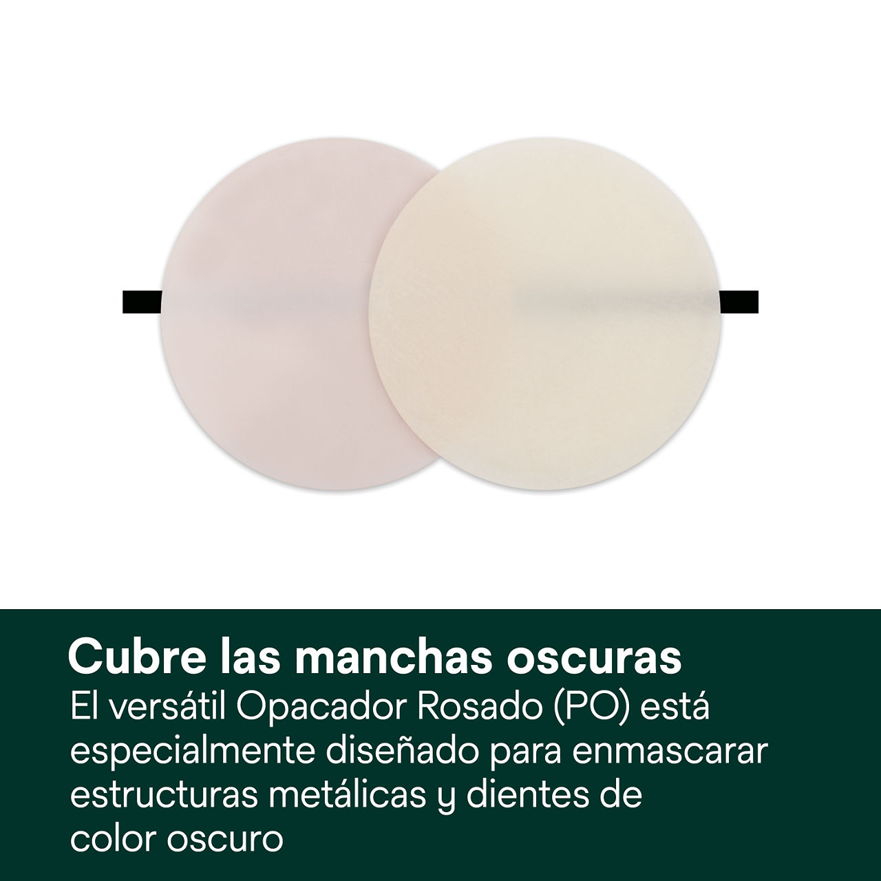 3- Filtek Universal: Cubre las manchas oscuras.